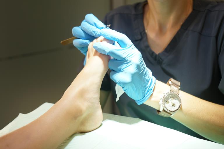 Patologías dermatológicas más frecuentes del pie